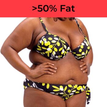 Large lady in a bikini. Morbidly obese +50% Body Fat