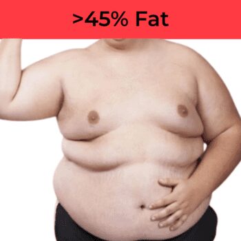 Large topless man. Overweight, morbidly obese +45% Body fat