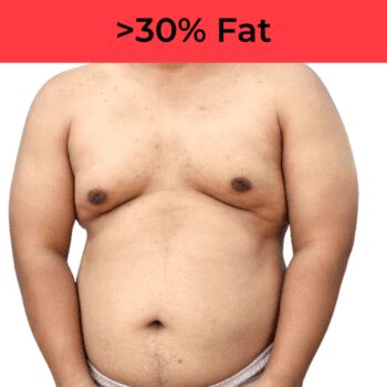 overweight topless man +30% Body Fat